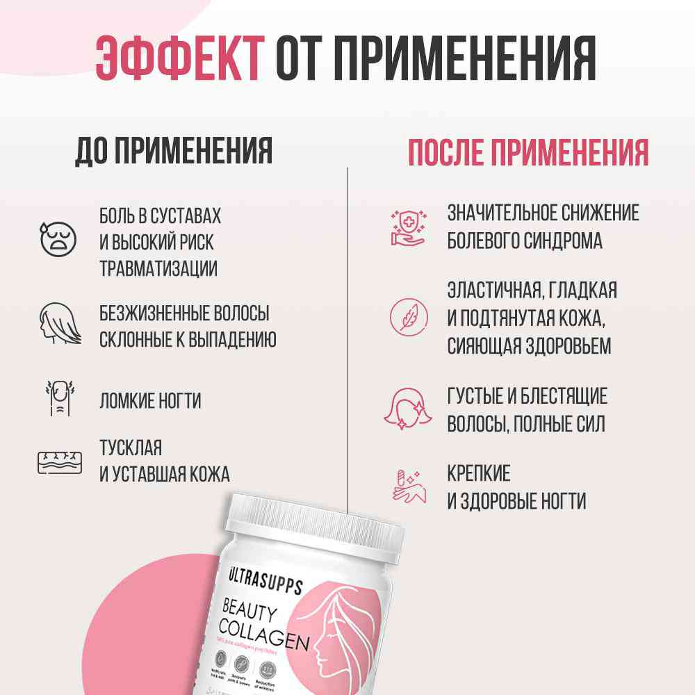 -5